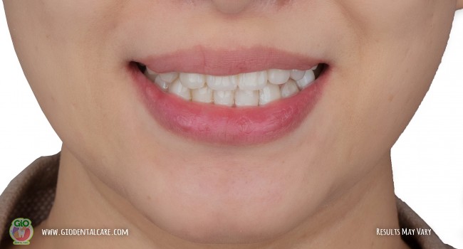 get-your-smile-here--1